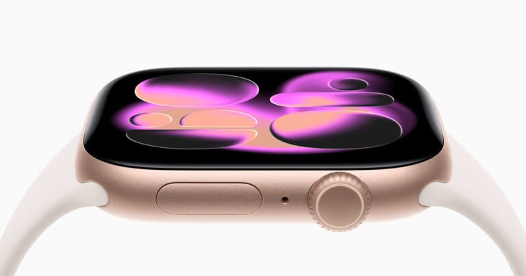 Apple Watch Series 11: Novo Foco em Sono, Bateria e 5G